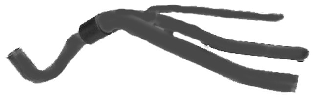 X RADYATOR UST HORTUMU LGN I 2.2 D 93 - 01